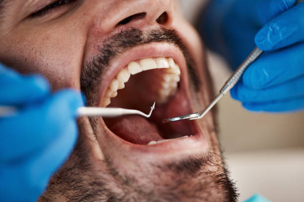Best Emergency Treatment for Oral Infections in Pulaski, WI